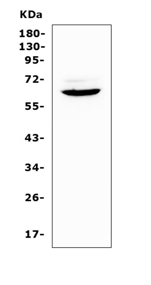 Polyclonal Rabbit anti-Mouse HPSE / Heparanase Antibody (WB)
