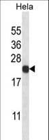 Polyclonal Rabbit anti-Human PSMB5 Antibody (aa235-263, IHC, WB)