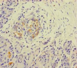KLHL3 Antibody