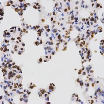 Polyclonal Rabbit anti-Human Histone H3 Antibody (Di-Methyl-Lys4, IHC, IF, WB)