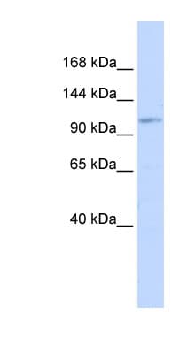 AVIL / Advillin Antibody (C-Terminus)