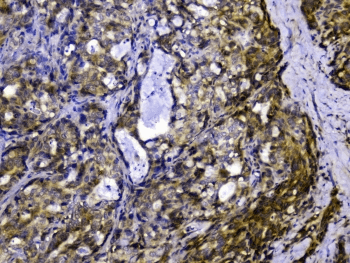 Polyclonal Rabbit anti-Human SIRT4 / Sirtuin 4 Antibody (IHC, WB)