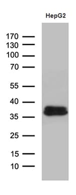 Monoclonal Mouse anti-Human M-PST / STM Antibody (clone OTI3G5, IHC, WB)