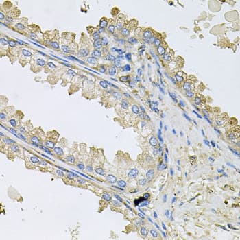 PPIC / Cyclophilin C Antibody