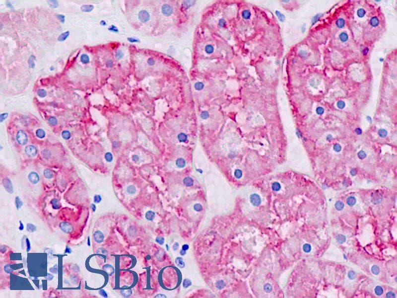 IHC-plus™ AQP1 / Aquaporin 1 Antibody (aa101-150)