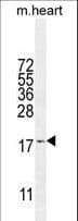 SNRNP27 Antibody (aa69-98)
