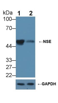 ENO2 / NSE Antibody (aa2-434)