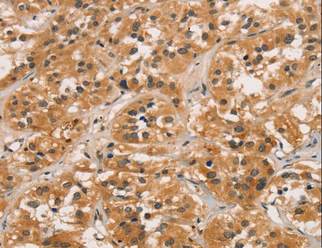 CTNNBIP1 / ICAT Antibody