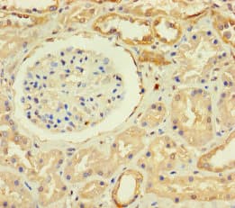 Polyclonal Rabbit anti-Human ZNF221 Antibody