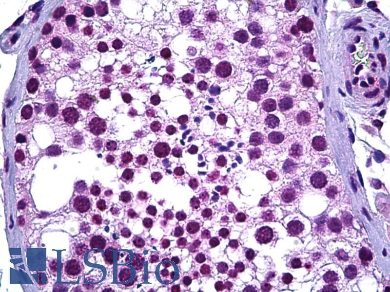 PathPlus™ Monoclonal Mouse anti-Human WT1 / Wilms Tumor 1 Antibody (clone 1E9, IHC, WB)