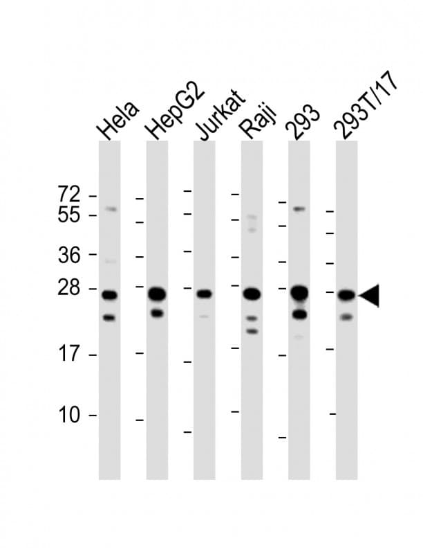 Polyclonal Rabbit anti-Human PCMT1 Antibody (Internal, WB)