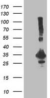 PNMT Antibody (clone OTI2A3)