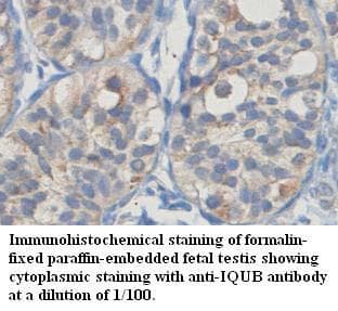 Polyclonal Rabbit anti-Human IQUB Antibody (aa448-619, IHC, WB)