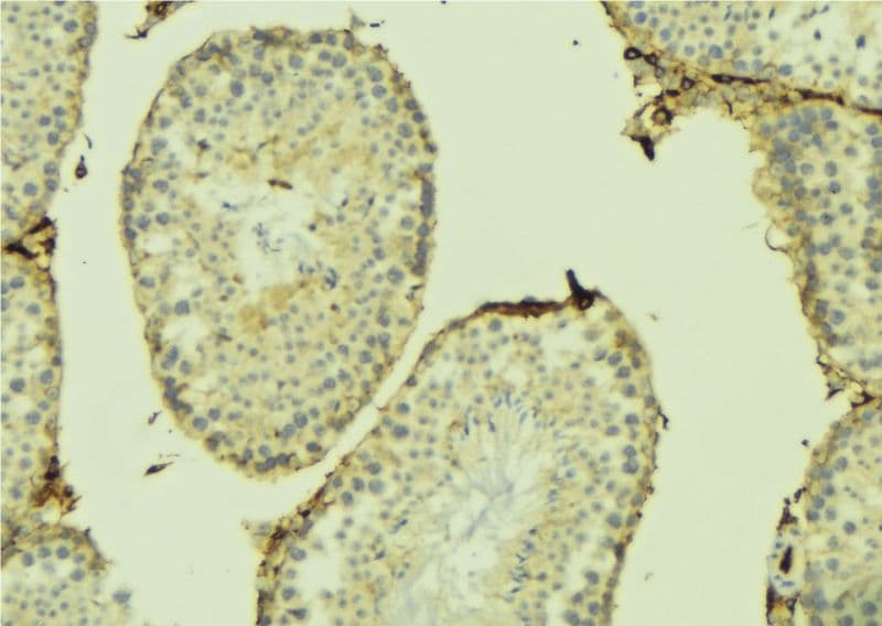 Polyclonal Rabbit anti-Human MRPL41 / PIG3 / BMRP Antibody (IHC, IF, WB)