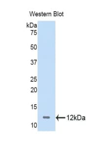 PathPlus™ NPM1 / NPM / Nucleophosmin Antibody (aa204-290)