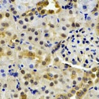 Polyclonal Rabbit anti-Human HPD Antibody (IHC, IF, WB)