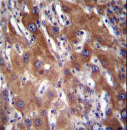 GLCNE / GNE Antibody (aa169-197)
