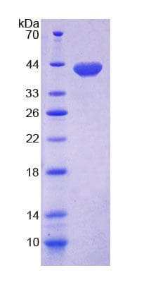 Mouse GCS1 / MOGS Protein (Recombinant His-T7, N-terminus)