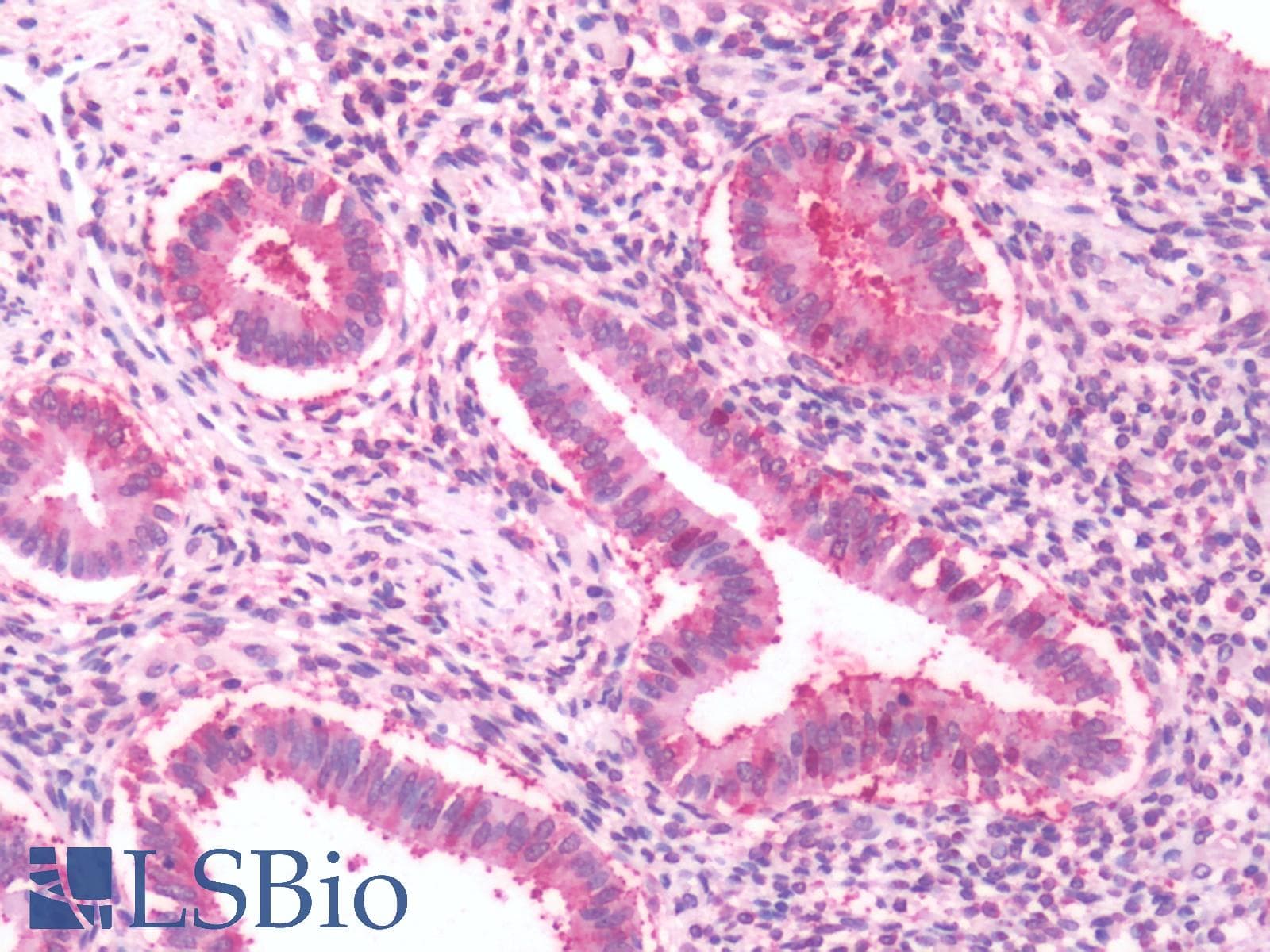 IHC-plus™ Polyclonal Rabbit anti-Human GPRC5A / RAI3 Antibody (Cytoplasmic Domain, IHC)