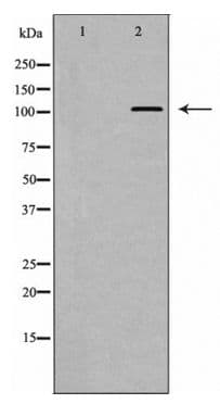 EPHA3 / EPH Receptor A3 Antibody