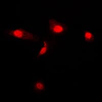 Polyclonal Rabbit anti-Human LGALS3 / Galectin 3 Antibody (Internal, IHC, IF, WB)