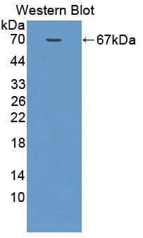 SMPD2 Antibody