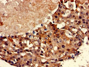TBP / GTF2D Antibody
