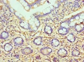 Polyclonal Rabbit anti-Human HYAL3 Antibody (aa198-417, IHC)