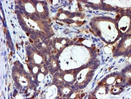 LIMK1 / LIMK Antibody (clone OTI6B4)