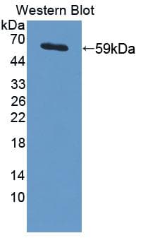 ITIH1 Antibody (aa412-664)