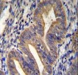 Polyclonal Rabbit anti-Human METTL10 Antibody (aa29-57, IHC, WB)
