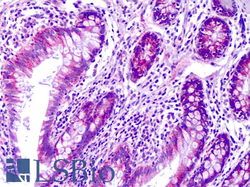 IHC-plus™ PRAGMIN / SGK223 Antibody (clone 5C6)