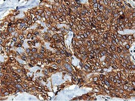 ILVBL Antibody (clone OTI8A12)