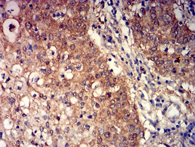 GRM3 / MGLUR3 Antibody (clone 6H10C3)