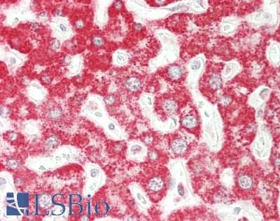 IHC-plus™ MCAD / ACADM Antibody (aa134-183)