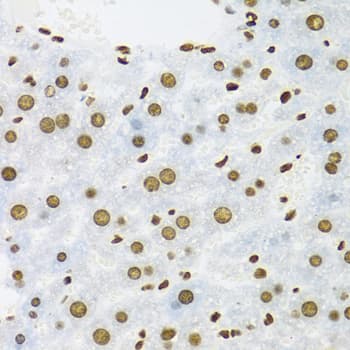 KHDRBS1 / SAM68 Antibody