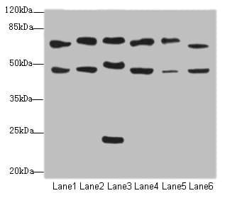 Polyclonal Rabbit anti-Human CSRNP2 / FAM130A1 Antibody (IHC, WB)