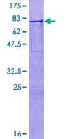 Human CYP26B1 Protein (Recombinant GST)