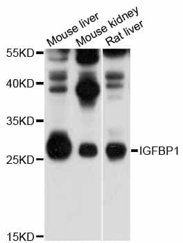 Polyclonal Rabbit anti-Human IGFBP1 Antibody (IHC, WB)