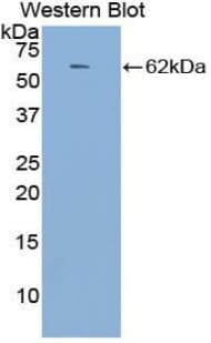 ACE / CD143 Antibody (aa814-1071)