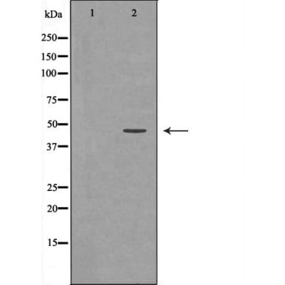 NCF1 / p47phox / p47 phox Antibody