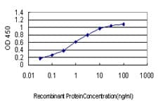 IHC-plus™ YY1 Antibody (clone 4A5)