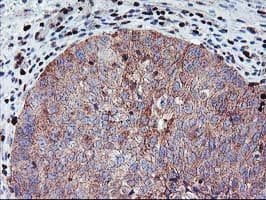 MEF2C Antibody (clone OTI1B6)