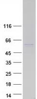 Human PDLIM7 / Enigma Protein (Recombinant Myc-DDK (Flag))