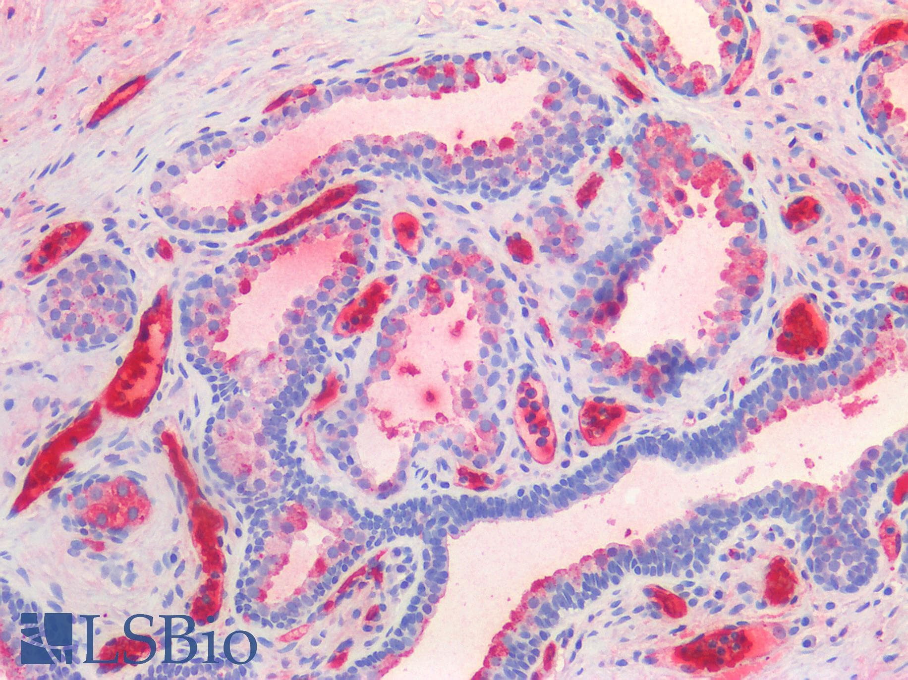 PathPlus™ Monoclonal Mouse anti-Human TIMP2 Antibody (clone 5B11, IHC, IF, WB)