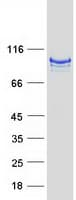 Human ITIH2 Protein (Recombinant Myc-DDK (Flag))
