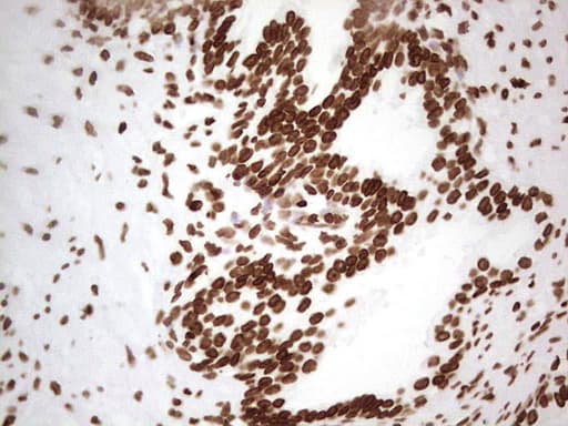 SETD1A / SET1 Antibody (aa1-320, clone OTI7B7)