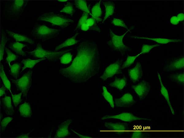 PBK / TOPK Antibody (clone 4A10)