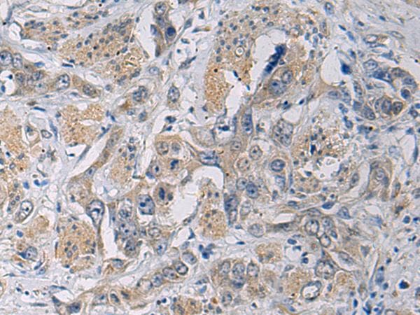 CYTIP Antibody