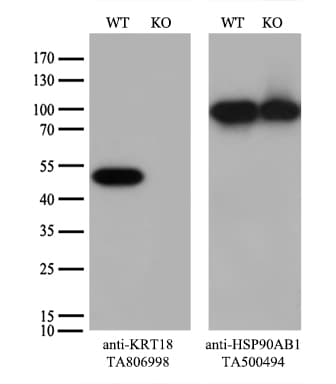 KRT18 / CK18 / Cytokeratin 18 Antibody (aa69-372, clone OTI2H10)